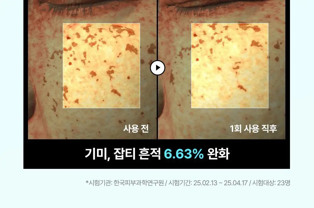 [피지흡착/10매] 메디힐 바이오 세컨덤 마스크 3종 (마데카소사이드, PDRN, 히알루론산) 상세페이지 11